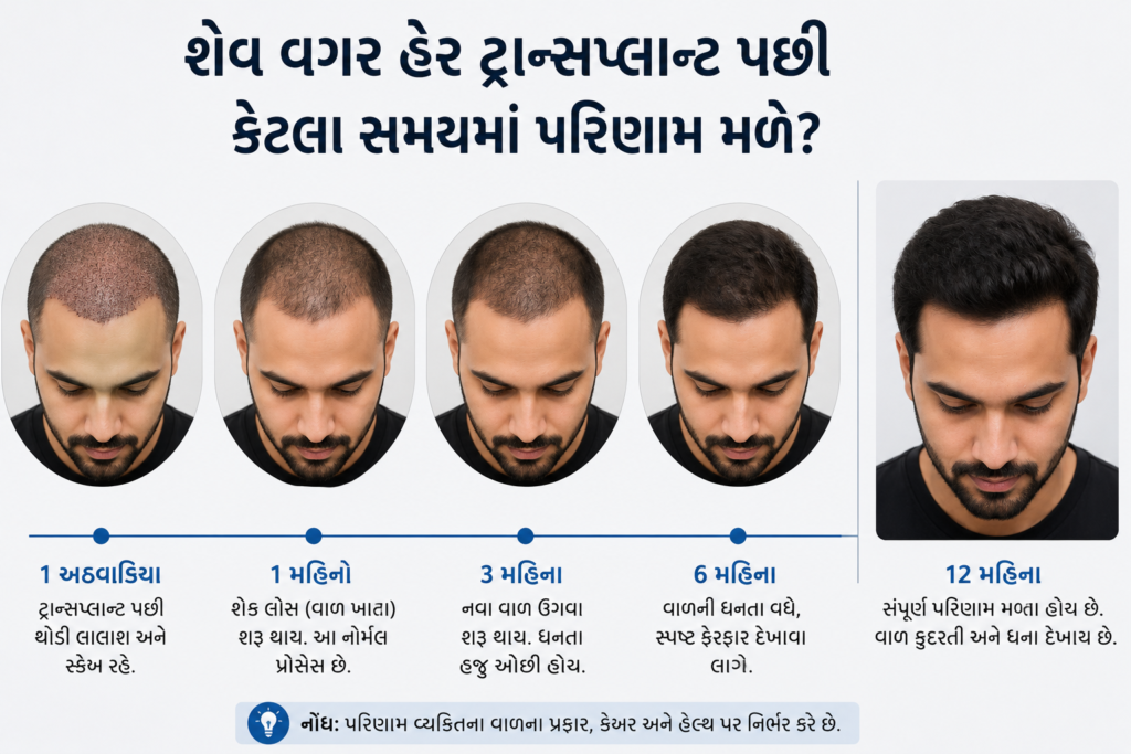 shave vagar hair transplant